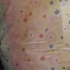 Beach Szálló Révfülöp Révfülöp - Egyéb