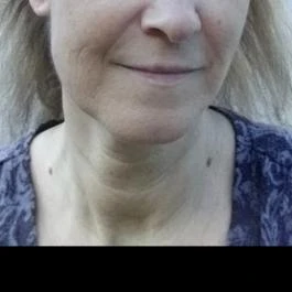 Pizza Porta, Budakeszi - Egyéb