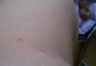 Hotel Juventus Velence