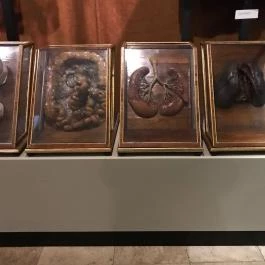 Semmelweis Orvostörténeti Múzeum, Könyvtár és Levéltár, Budapest - 