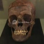 Semmelweis Orvostörténeti Múzeum, Könyvtár és Levéltár Budapest - 