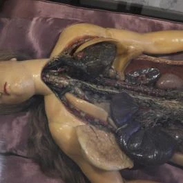 Semmelweis Orvostörténeti Múzeum, Könyvtár és Levéltár Budapest - Egyéb